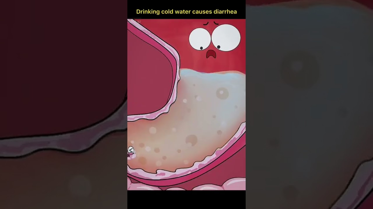 water causes diarrhea