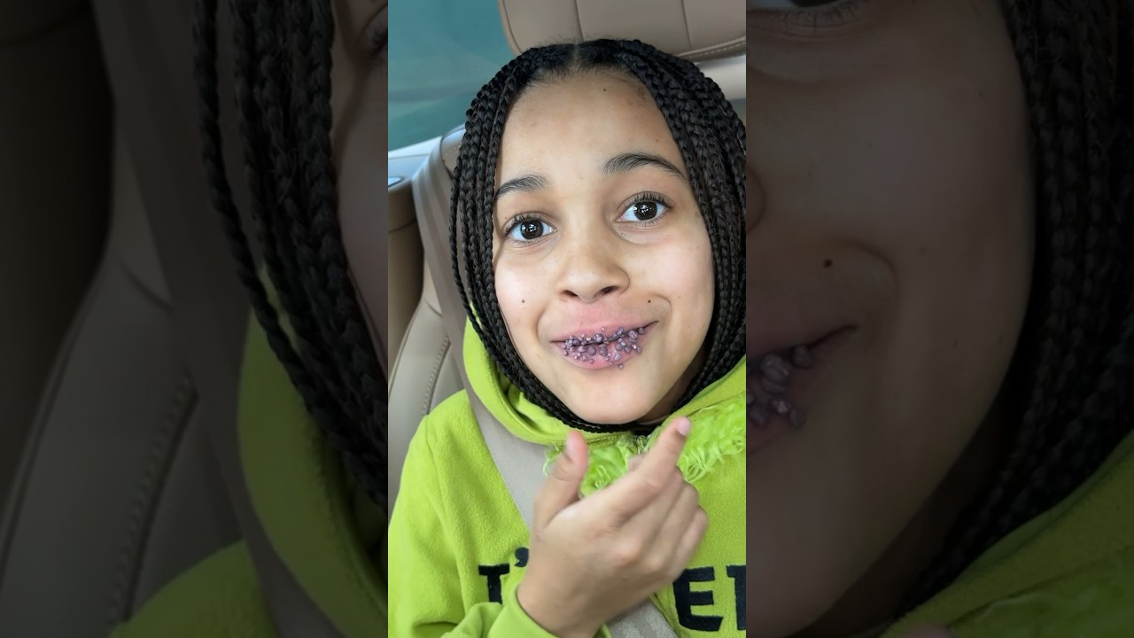 WE FOUND OUT WHAT’S WRONG WITH HER LIPS!! 😲