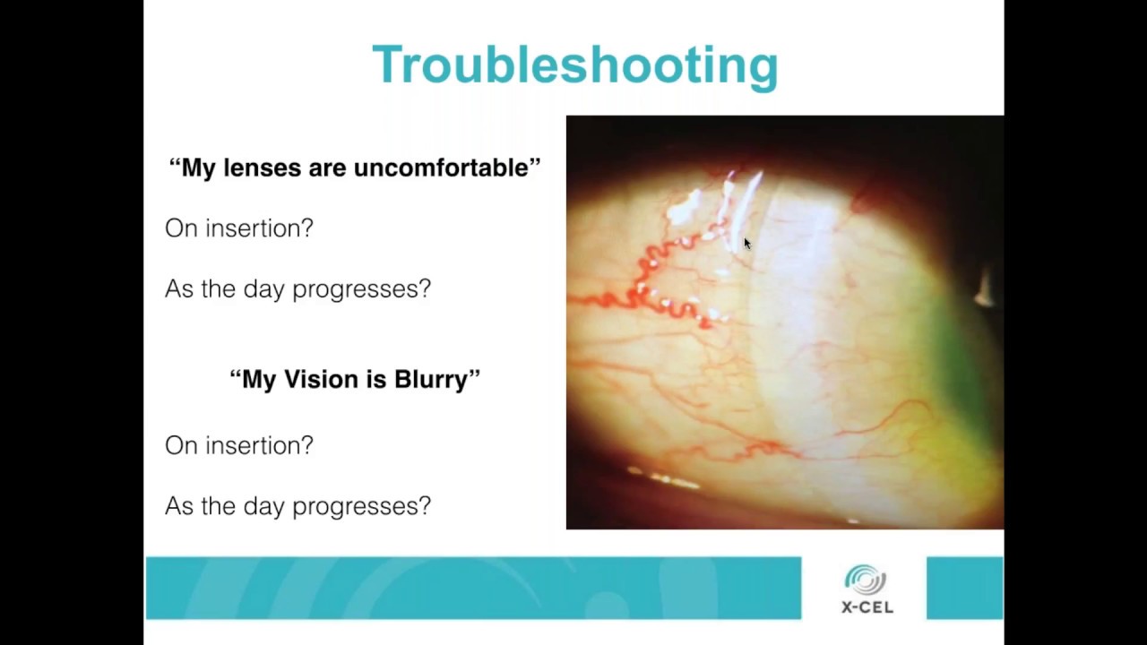 WEBINAR:  Scleral Lens Troubleshooting: Fogging and Debris (Tangible Hydra-PEG)