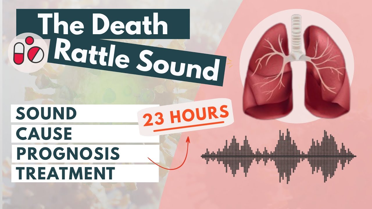 What does the death rattle sound like? | Signs of approaching death