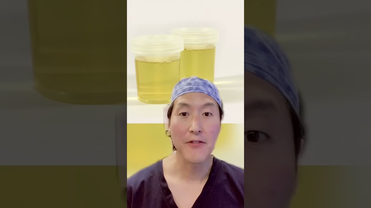 What Happens if You Drink Pee? Urine Therapy?!?! 😳😳 #shorts