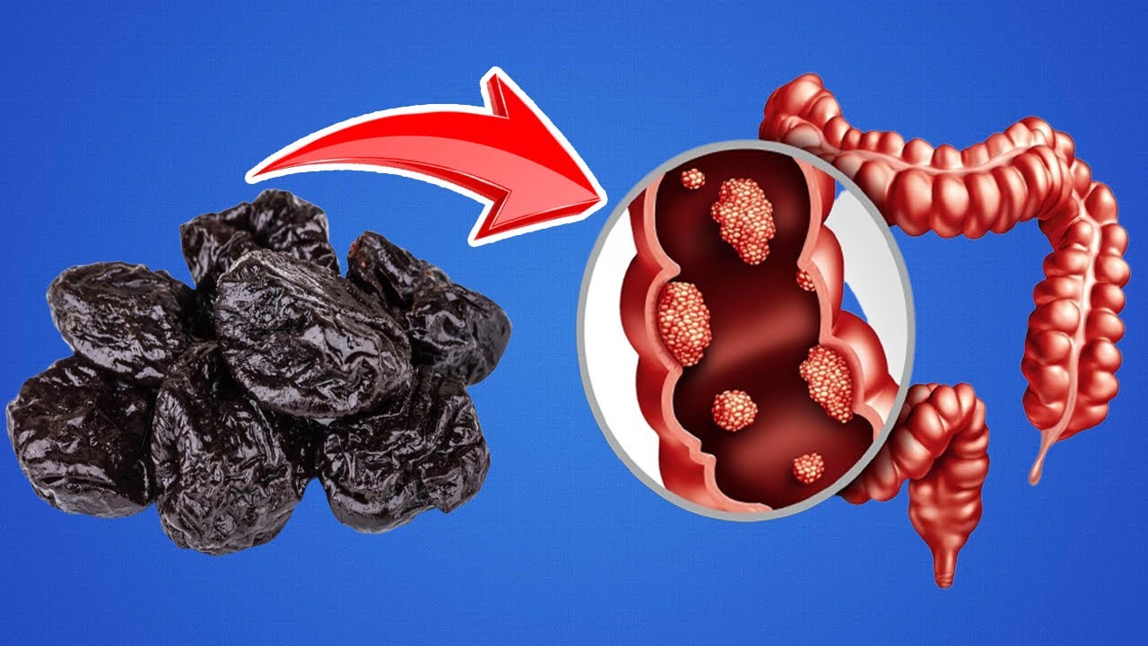 What Happens to Your Body When You Eat Prunes Everyday || Prunes Benefits
