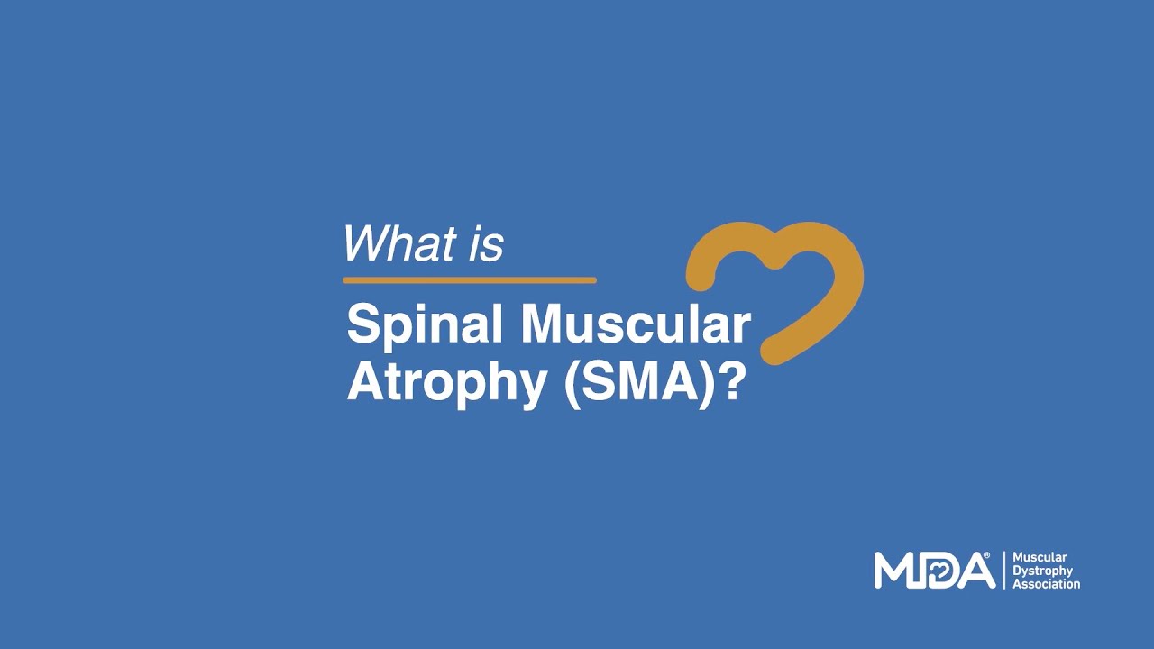 What is SMA?