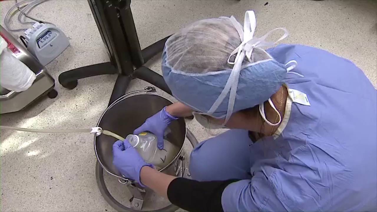 What Lung Washing Looks Like