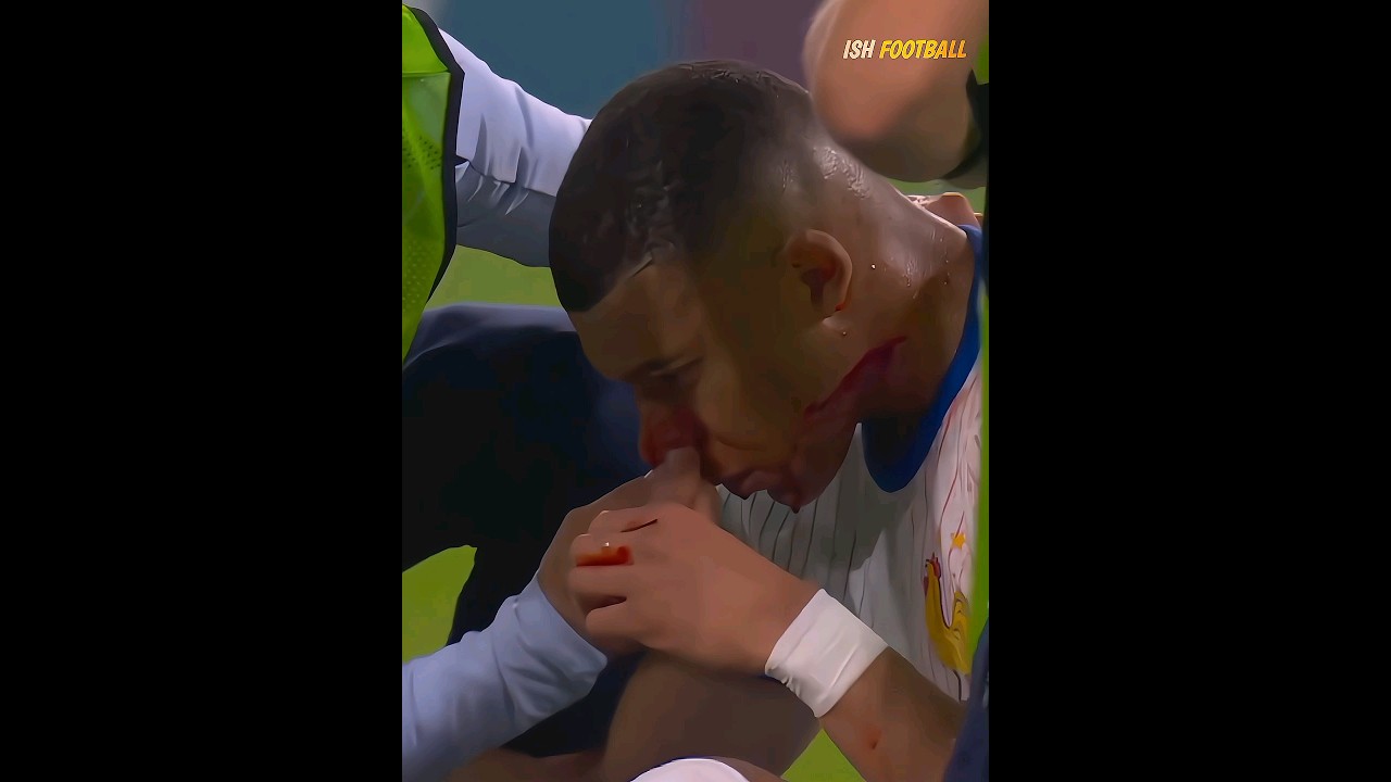 When Players Break Their Nose 👃