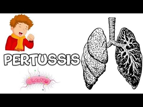 Whooping cough | pertussis Causes, Symptoms, Treatment, Prevention