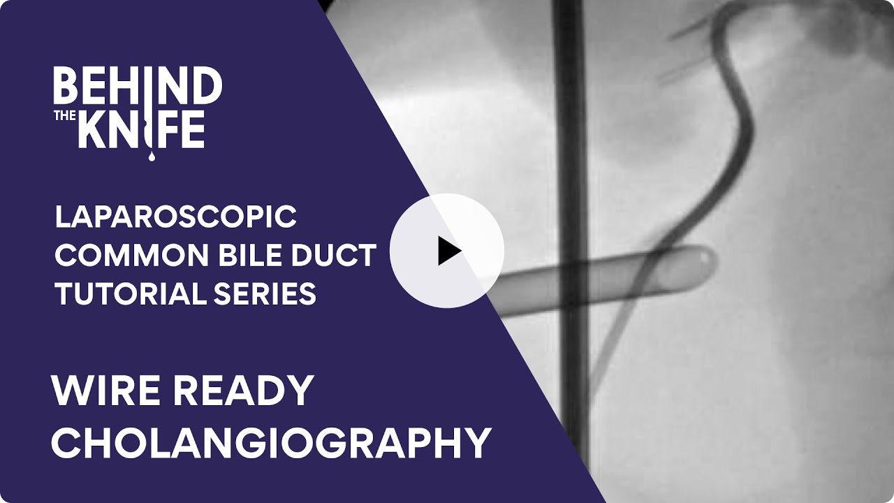 Wire Ready Cholangiography | Laparoscopic Common Bile Duct Tutorial Series: Ep. 2