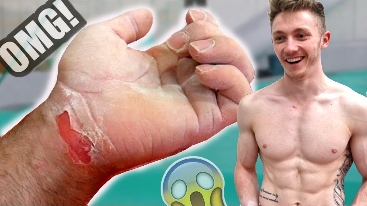 Worst Gymnastics RIP you've ever seen!? *OUCH*