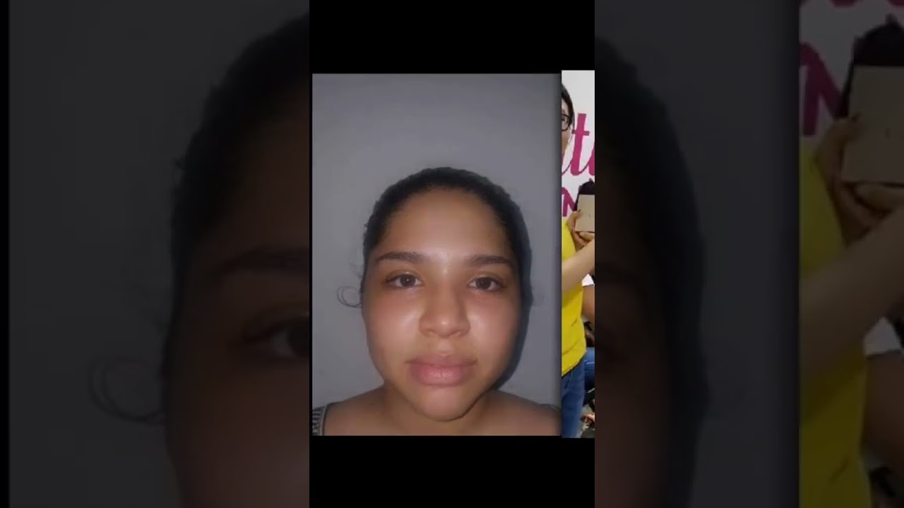 yeri mua ANTES Y DESPUES DE SUS CIRUGIAS