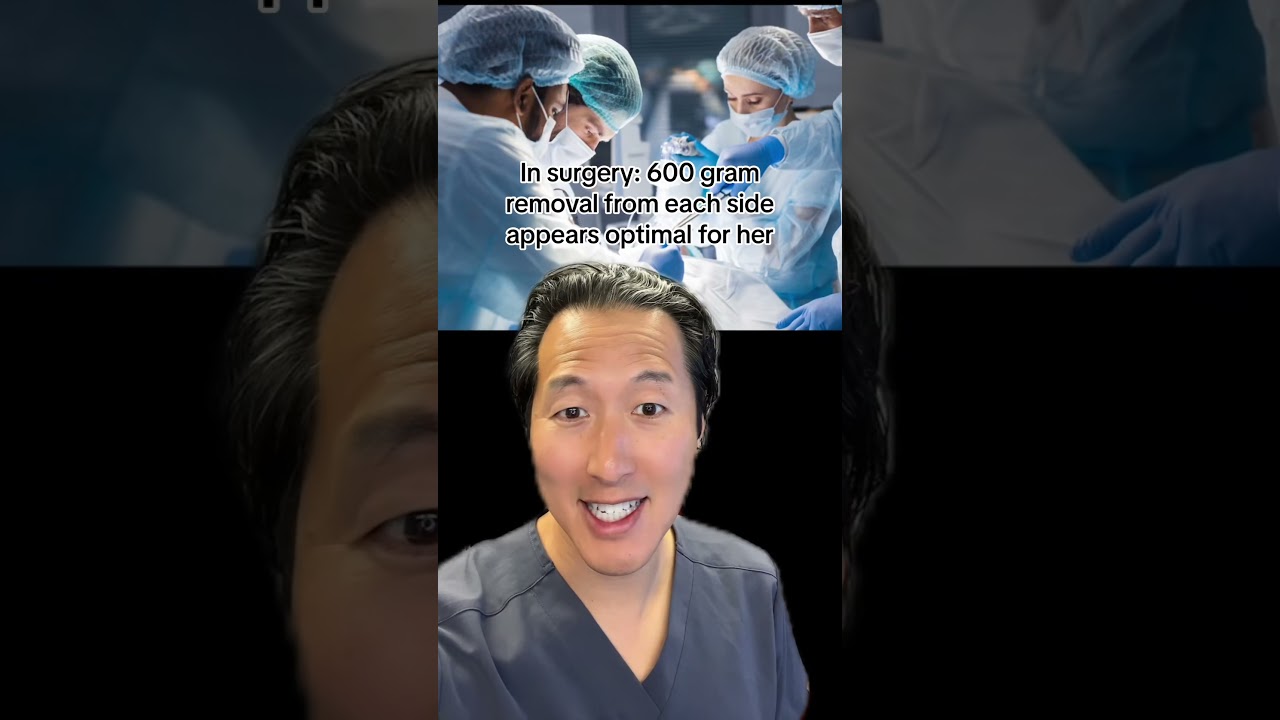 YOU Are The Plastic Surgeon… What Would You Do With This Breast Reduction? #breastreduction