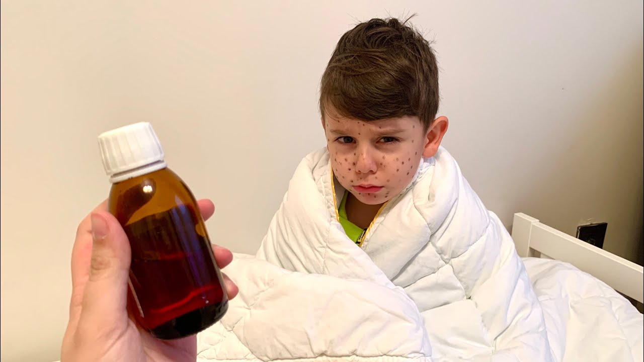 Yusuf okula gitmemek için hasta taklidi yaptı🤒Yüzünü boyadı ama annesini kandıramadı👻🤪