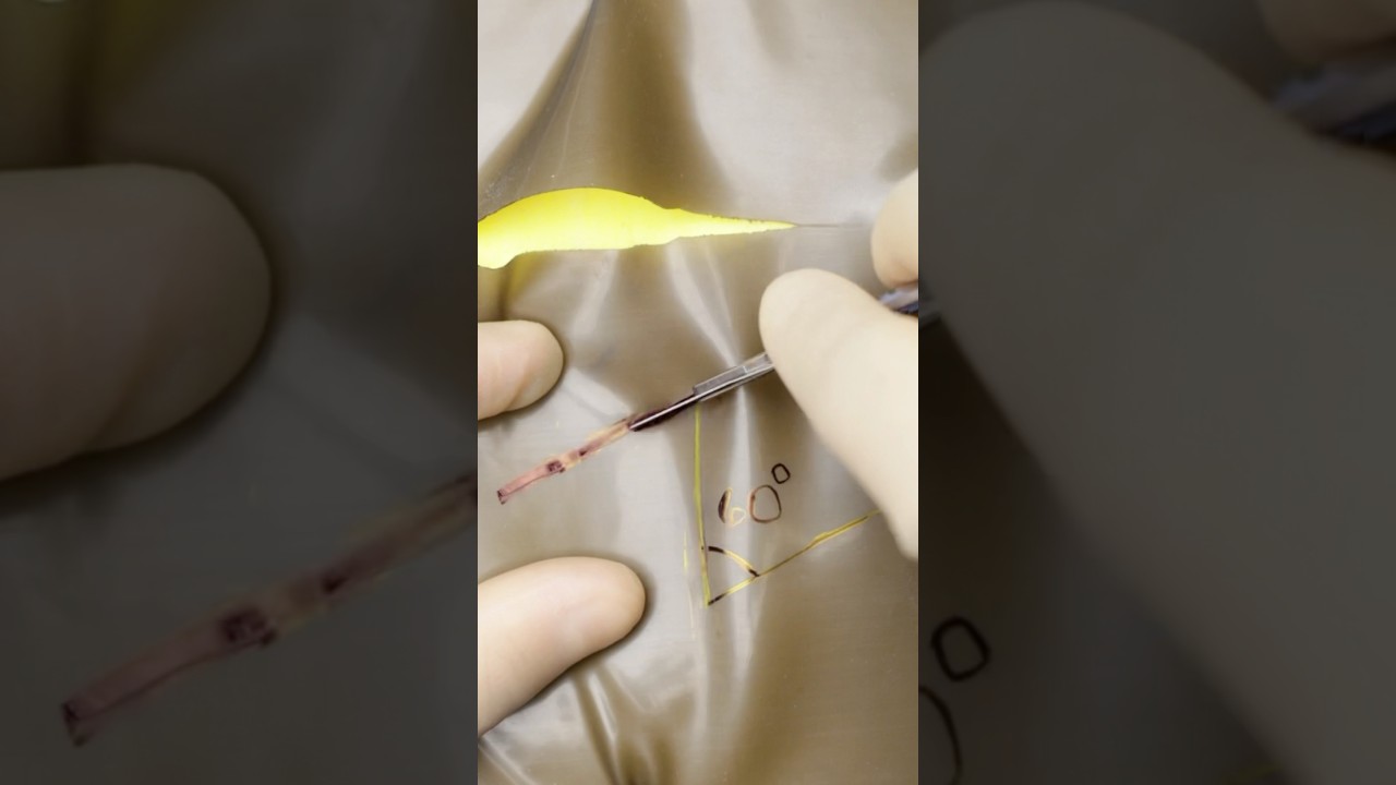 Z-Plasty #surgery #suturing #stitches #vet #medicine #surgeon #surgeonlife #woundcare #asmr #funfact